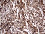 IGSF11 Monoclonal Antibody (OTI1B9)