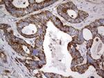 IGSF11 Antibody in Immunohistochemistry (Paraffin) (IHC (P))