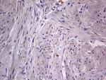 IGSF11 Antibody in Immunohistochemistry (Paraffin) (IHC (P))