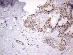 IGSF11 Antibody in Immunohistochemistry (Paraffin) (IHC (P))