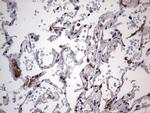 IGSF11 Antibody in Immunohistochemistry (Paraffin) (IHC (P))