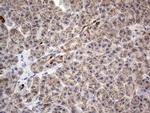 IGSF11 Antibody in Immunohistochemistry (Paraffin) (IHC (P))