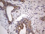 IGSF11 Antibody in Immunohistochemistry (Paraffin) (IHC (P))