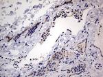 IGSF11 Antibody in Immunohistochemistry (Paraffin) (IHC (P))