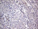 IGSF11 Antibody in Immunohistochemistry (Paraffin) (IHC (P))