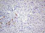 IGSF11 Antibody in Immunohistochemistry (Paraffin) (IHC (P))