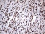 CK1 epsilon Monoclonal Antibody (OTI5D4)