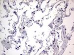 RTRAF Antibody in Immunohistochemistry (Paraffin) (IHC (P))