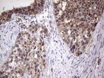 PPP2R5D Antibody in Immunohistochemistry (Paraffin) (IHC (P))