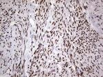 RTRAF Monoclonal Antibody (OTI1E5)