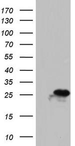 PAFAH1B3 Antibody in Western Blot (WB)