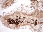 NOR-1 Antibody in Immunohistochemistry (Paraffin) (IHC (P))
