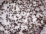 hnRNP L Antibody in Immunohistochemistry (Paraffin) (IHC (P))