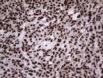 hnRNP L Antibody in Immunohistochemistry (Paraffin) (IHC (P))
