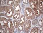 MTF1 Antibody in Immunohistochemistry (Paraffin) (IHC (P))