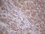 MTF1 Antibody in Immunohistochemistry (Paraffin) (IHC (P))