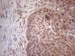 MTF1 Antibody in Immunohistochemistry (Paraffin) (IHC (P))