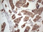 MTF1 Antibody in Immunohistochemistry (Paraffin) (IHC (P))