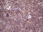 PRKD3 Antibody in Immunohistochemistry (Paraffin) (IHC (P))
