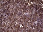 ANGPTL1 Antibody in Immunohistochemistry (Paraffin) (IHC (P))