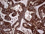 LRRTM1 Antibody in Immunohistochemistry (Paraffin) (IHC (P))