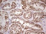 LRRC6 Antibody in Immunohistochemistry (Paraffin) (IHC (P))