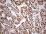 LRRC6 Antibody in Immunohistochemistry (Paraffin) (IHC (P))