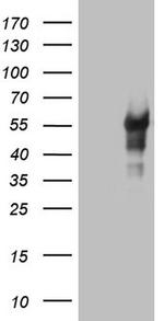 LRRC6 Antibody in Western Blot (WB)