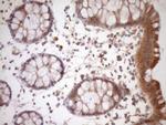 FSIP1 Antibody in Immunohistochemistry (Paraffin) (IHC (P))
