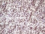 GLI4 Antibody in Immunohistochemistry (Paraffin) (IHC (P))