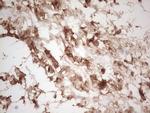 CK1 gamma-1 Antibody in Immunohistochemistry (Paraffin) (IHC (P))