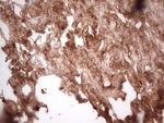 CK1 gamma-1 Antibody in Immunohistochemistry (Paraffin) (IHC (P))