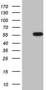 CK1 gamma-1 Antibody in Western Blot (WB)