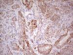 CK1 gamma-1 Antibody in Immunohistochemistry (Paraffin) (IHC (P))