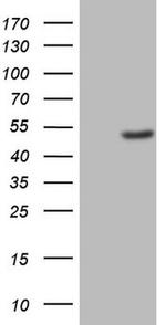 CK1 gamma-1 Antibody in Western Blot (WB)