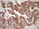 WIBG Antibody in Immunohistochemistry (Paraffin) (IHC (P))