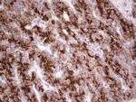 SYNM Antibody in Immunohistochemistry (Paraffin) (IHC (P))