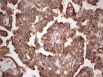 SYNM Antibody in Immunohistochemistry (Paraffin) (IHC (P))