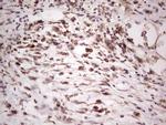SYNM Antibody in Immunohistochemistry (Paraffin) (IHC (P))