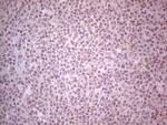 GABRA5 Monoclonal Antibody (OTI1G5)