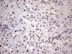 NUDT21 Antibody in Immunohistochemistry (Paraffin) (IHC (P))