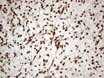 ALOX5 Antibody in Immunohistochemistry (Paraffin) (IHC (P))