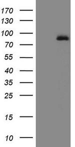 ALOX5 Antibody in Western Blot (WB)
