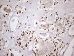 53BP1 Antibody in Immunohistochemistry (Paraffin) (IHC (P))