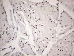 53BP1 Antibody in Immunohistochemistry (Paraffin) (IHC (P))