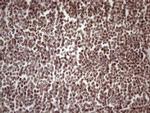 53BP1 Antibody in Immunohistochemistry (Paraffin) (IHC (P))