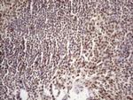 53BP1 Antibody in Immunohistochemistry (Paraffin) (IHC (P))