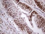53BP1 Antibody in Immunohistochemistry (Paraffin) (IHC (P))