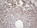 53BP1 Antibody in Immunohistochemistry (Paraffin) (IHC (P))