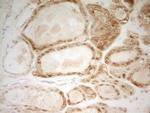 HMG20A Antibody in Immunohistochemistry (Paraffin) (IHC (P))